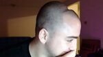 Mizkif twitch clips that brain my deNT - YouTube