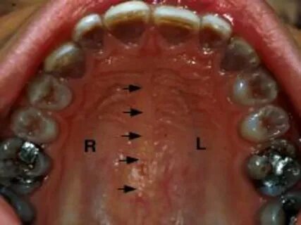 ORAL PATHOLOGY. - ppt download