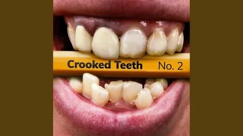 Crooked Teeth - YouTube