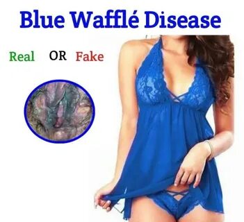 The Blue Waffles Disease Pics - Quotes Home