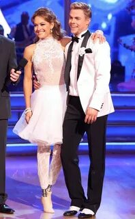 Amy Purdy Hospitalized After Dancing With the Stars Performa
