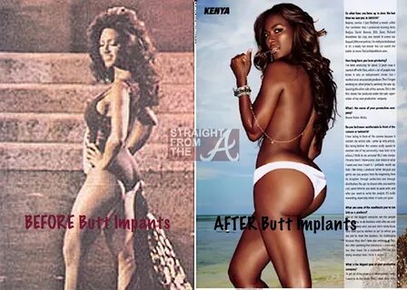 kenya-moore-before-after-butt-implants - Straight From The A
