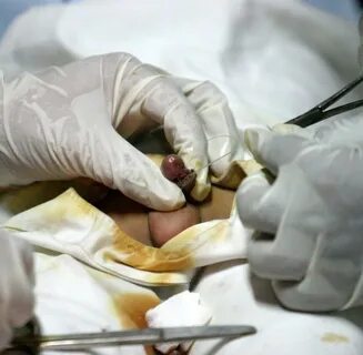 Beschneidung: Das Zerrbild vom bösen Juden mit blutigem Mess