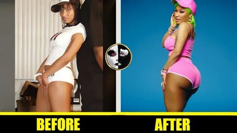 Nicki minaj before boob and butt implants