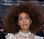 Solange shares a throwback pic of her wedding day hives, and