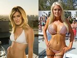 Total Transformation of Heidi Montag - Lovely Surgery