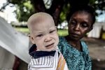 Tanzania albino girl among hundreds seeking refuge from murd