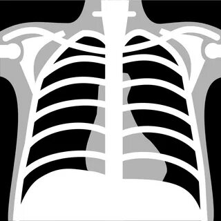 File:X-rays chest neg icon.svg - Wikimedia Commons
