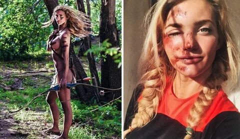 Naked and Afraid' Reality Star Melissa Miller Took an Ugly S
