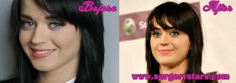 Katy Perry Plastic Surgery - Before and After Shoots