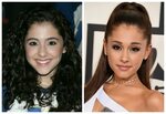 before & after ariana grande, nose job.. http://images.lifea