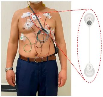 The left panel shows a participant wearing a Holter monitoring and an adhes...