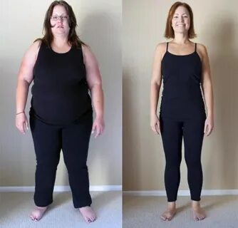 Weight Loss Surgery in Philadelphia - Bariatric Surgery Sour