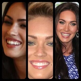 Megan Fox Before/After Veneers Perfect smile, Plastic surger