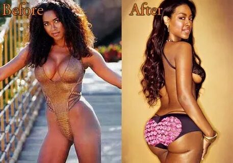 Kenya Moore Plastic Surgery, Before and After Butt Implants 