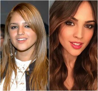 15 Jóvenes famosas que ya se sometieron al bisturí