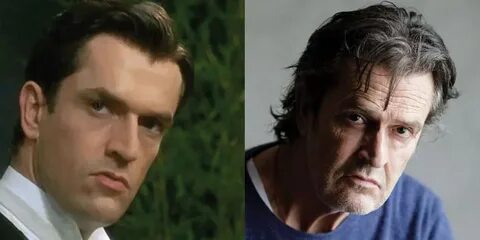 Rupert Everett Plastic Surgery Before and After Pictures 202