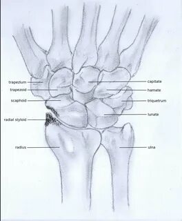 Arthritis Joint Pain. Do I Have Osteoarthritis? Specialty Sp