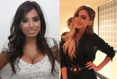 Anitta fez Cirurgia no Nariz - Fotos ANTES e DEPOIS