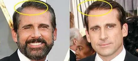 Steve Carell Plastic Surgery - Plastic Industry In The World