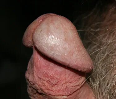 nude penis head - milan-st.ru.