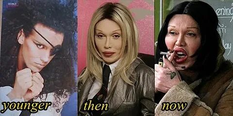 Pete Burns Plastic Surgery Before and After Bad Plastic Surg