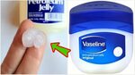 This Is Why You Need To Stop Using Vaseline - YouTube
