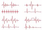 Heartbeat Monitor Graphic Line Heart monitor tattoo, Heartbe