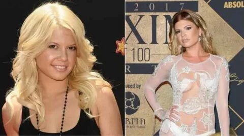 Chanel West Coast Plastic Surgery Transformation - What’s th