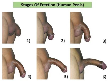 Photo de penis en erection