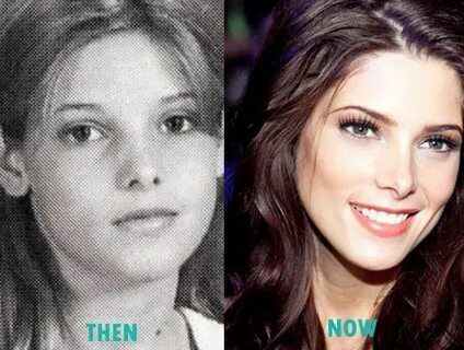 Ashley Greene Plastic Surgery Nose Job Before and After