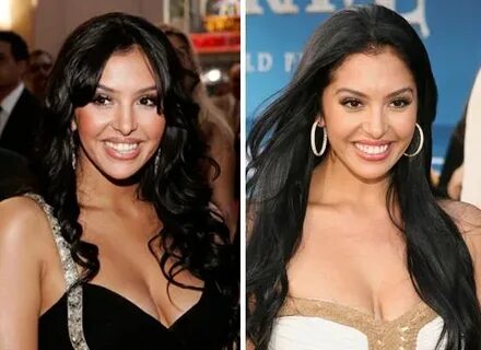13 Celebs Before and After Plastic Surgery in 2020 Plastic s