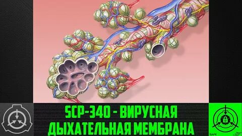 SCP-340 - Вирусная дыхательная мембрана (СТАРАЯ ОЗВУЧКА) - Y
