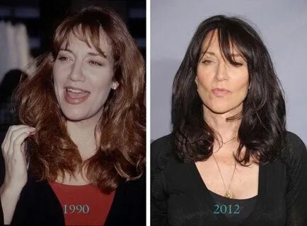 Katey Sagal Plastic Surgery Before & After Plastic surgery, 