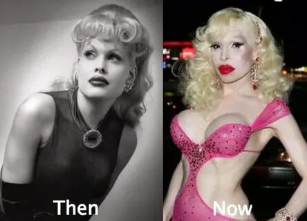 Amanda Lepore Plastic Surgery Gone Wrong - Latest Plastic Su