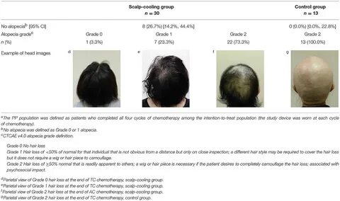 Frontiers Efficacy of Scalp Cooling in Preventing and Recove