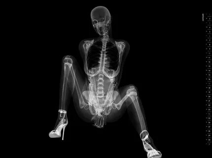 Женщина под рентгеном (56 фото) - Порно фото голых девушек