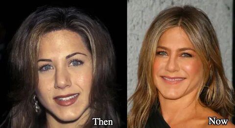 Jennifer Aniston Plastic Surgery Before and After Photos