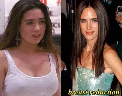 Jennifer Connelly Breast Reduction Plastic Surgery, Fact or 