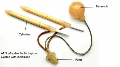 How to use a penile pump 👉 👌 How To Use Cock Rings For Stron