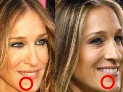 Sarah jessica parker plastic surgery World Celebrity