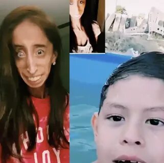 Disability activist Lizzie Velasquez condemns FaceTime TikTo