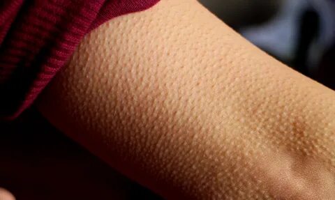 If You Get Goosebumps While Listening to Music Your Brain Co