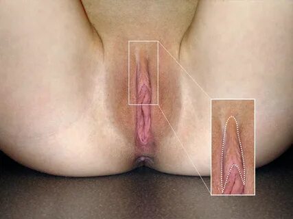 Klitorisvorhaut - Wikipedia