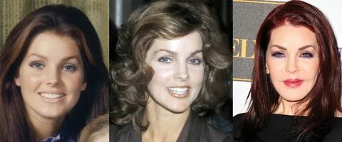 Priscilla Presley Plastic Surgery Before and After Pictures 