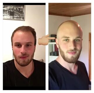 Would You Date A Bald Guy Reddit slsi.lk