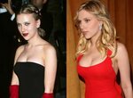 Has Scarlett Johansson Had Plastic Surgery?