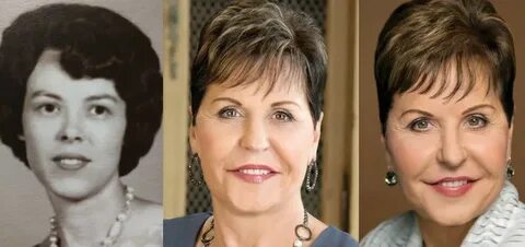 Joyce Meyer Plastic Surgery Before and After Pictures 2022