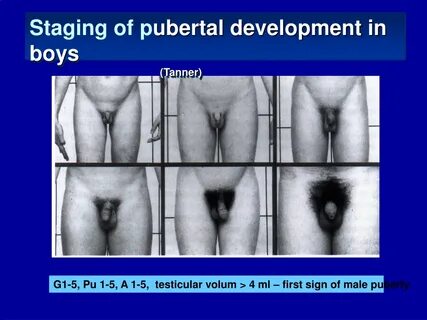PPT - Puberty Disorders PowerPoint Presentation, free download - ID:9437680