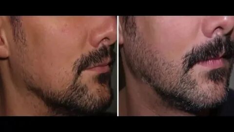 Щетина у мужчин: фото, виды, чем брить бороду, как отрастить